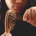 Natural Remedies for Female Hair Loss: Solutions and Treatments