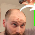 Understanding Hair Fibers and Their Role in Preventing Hair Loss