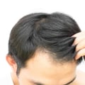 Hair Thickening Sprays: The Ultimate Guide to Preventing Hair Loss and Regrowing Your Hair