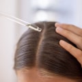Serums and Oils for Hair Growth: How to Prevent Baldness and Promote Hair Restoration