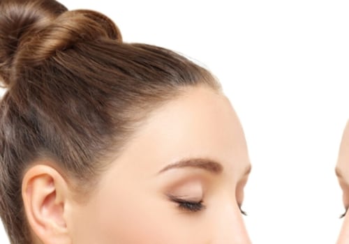Lifestyle Changes for Preventing Female Hair Loss