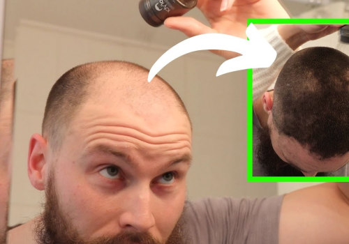 Understanding Hair Fibers and Their Role in Preventing Hair Loss