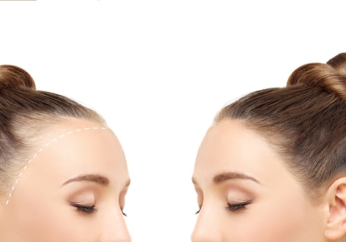 Hair Care Routine for Managing Female Hair Loss