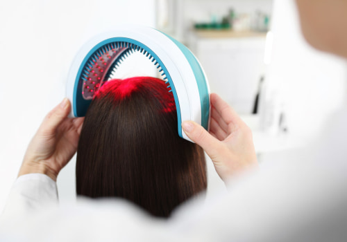 Low-Level Laser Therapy (LLLT) for Hair Loss: What You Need to Know