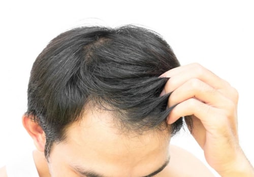 Hair Thickening Sprays: The Ultimate Guide to Preventing Hair Loss and Regrowing Your Hair