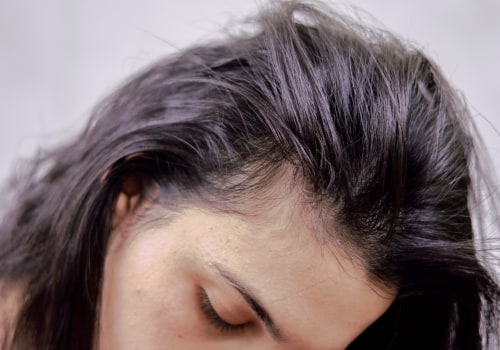 Vitamin D for Hair Growth: The Ultimate Guide